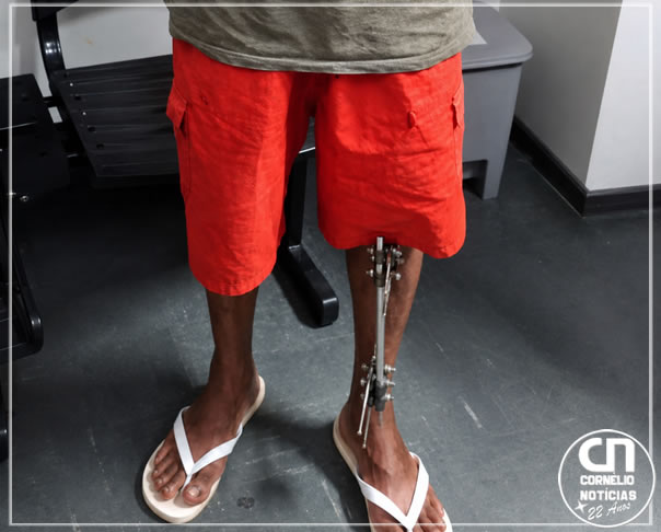 Homem com perna fraturada é preso após invasão e tentativa de furto